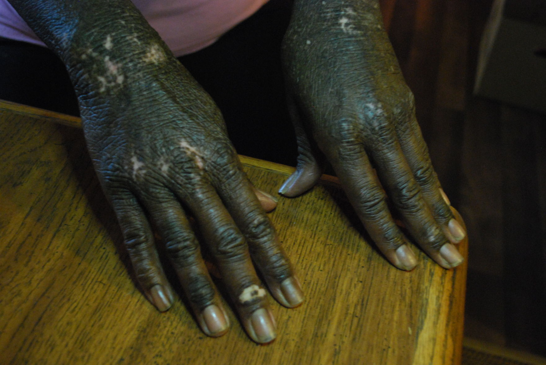 abc hands.JPG